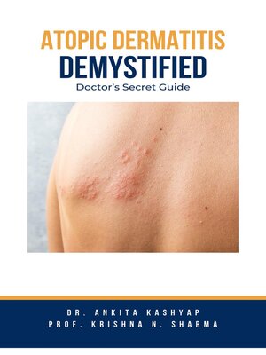 cover image of Atopic Dermatitis Demystified